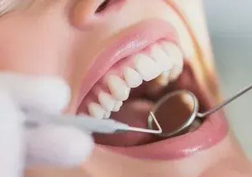 Лечение зубов