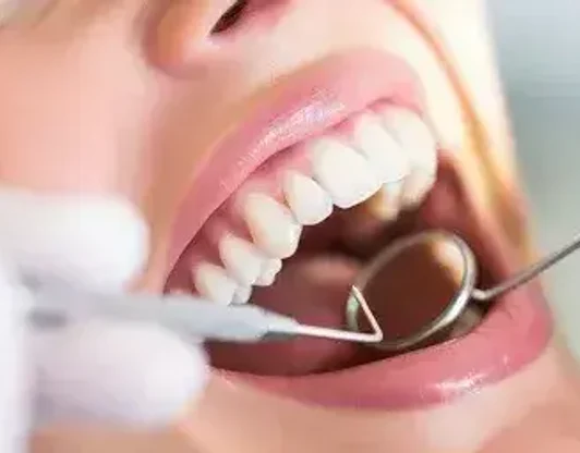 Лечение зубов